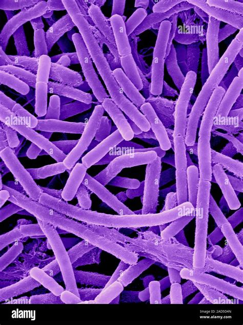 Coloured Scanning Electron Micrograph Sem Of Bacillus Anthracis