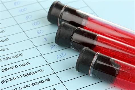 Hiponatremia Que Es Principales Causas Y Tratamiento Maestria Salud