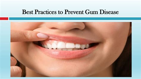 Ppt Best Practices To Prevent Gum Disease Powerpoint Presentation Free Download Id 11895966