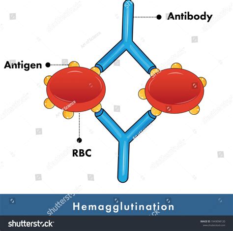 Hemagglutination Assay Used Blood Grouping Blood Stock Vector (Royalty Free) 1949098120 ...