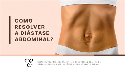 Entenda O Que Di Stase Abdominal E Como Resolv La Dr Esa