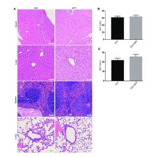 Effects Of APF On Inflammatory Markers In DN Kidneys A C The MRNA