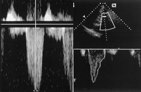 An Image Showing Measurement Of Tvi Rvot And Trv Tvi Rvo T Time Download Scientific Diagram