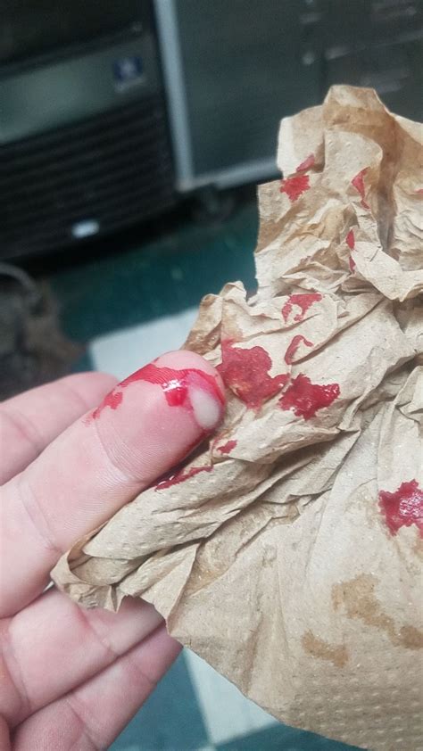 Fucking Knife Bit Me Imgur