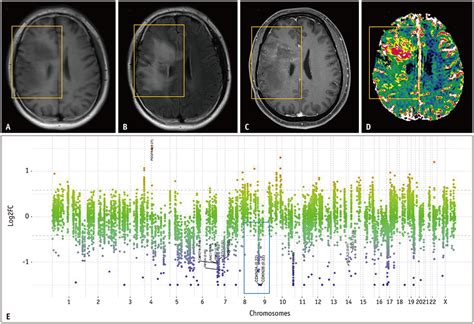 Qualitative And Quantitative Magnetic Resonance Imaging Phenotypes May