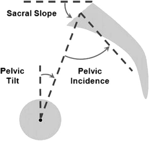 Pelvic Tilt Evaluation From Frontal Radiographs The Validity