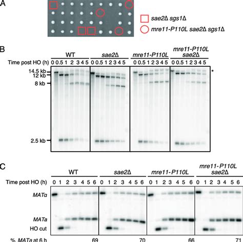 Fig S3 Mre11 P110l Does Not Restore End Resection Or Affect Hr A Download Scientific