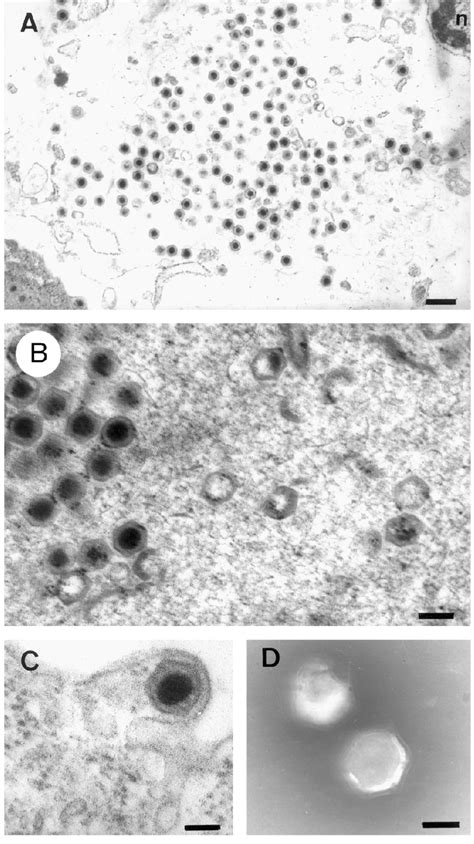 Transmission Electron Micrographs Of The Grouper Virus Infected Cells