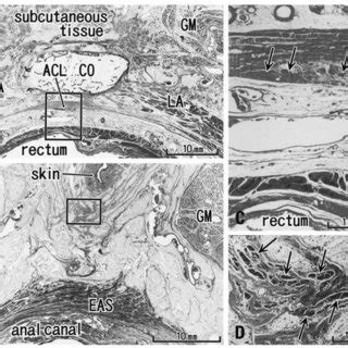 Horizontal Sections Of The Anal Canal In A Week Fetus A