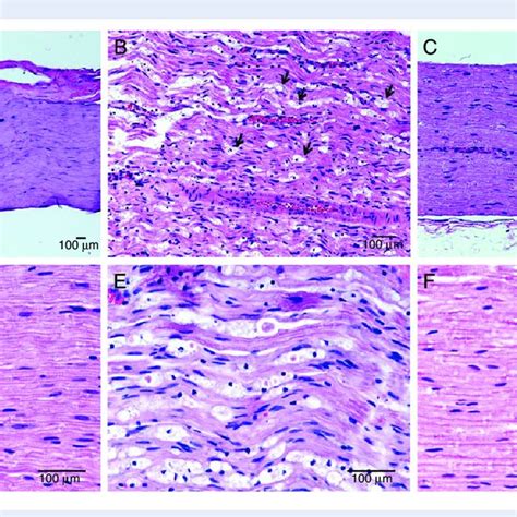 Photomicrographs Of Haematoxylin And Eosin Stained Sections Of A