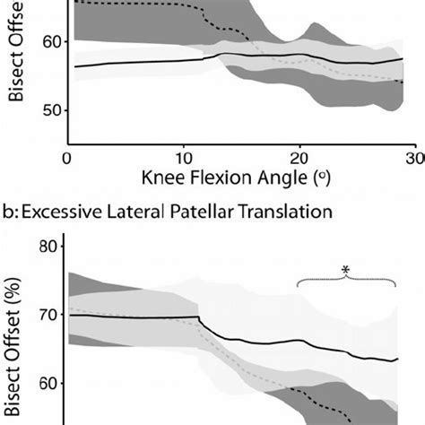 Diagram Of A Bisect Offset Bo And B Patellar Tilt Θ