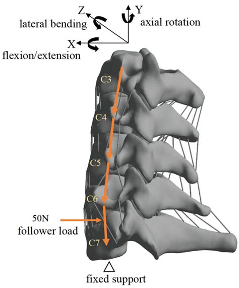 Frontiers Biomechanical Evaluation Of A Novel Anterior Transpedicular