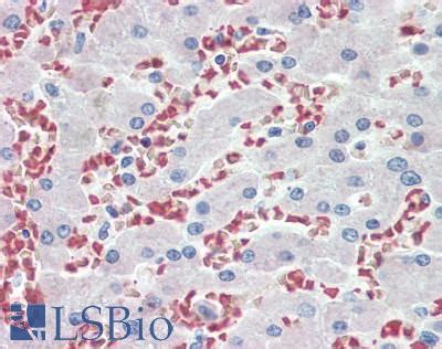 IHC-plus™ HBB / Hemoglobin Beta Polyclonal Antibody Rabbit | LSBio