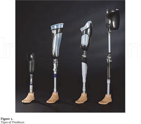 Figure 1 From Prosthetics For Lower Limb Amputation Semantic Scholar