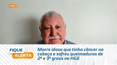 Morre Idoso Que Tinha C Ncer Na Cabe A E Sofreu Queimaduras De E