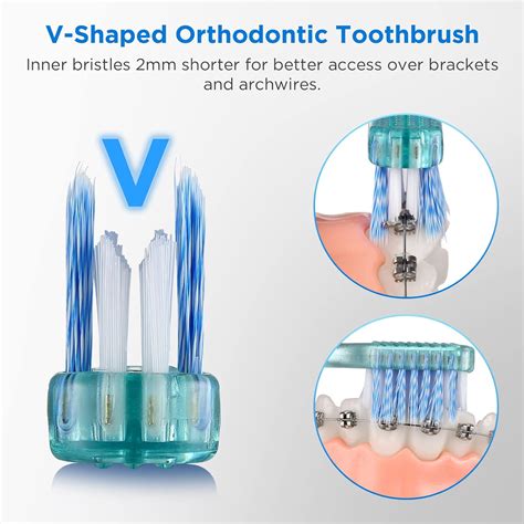 Fregum Cepillo de dientes ortodóntico en forma de V para aparatos