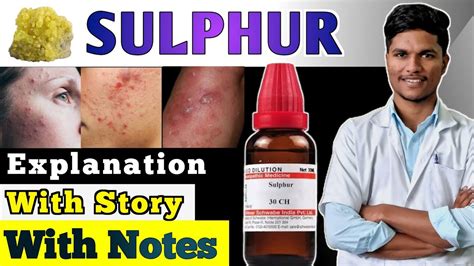 Sulphur Homoeopathic Medical Explanation In Hindi Homoeopathy