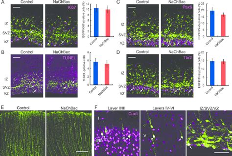 Proliferation Neuronal Differentiation Apoptosis And Radial Glial