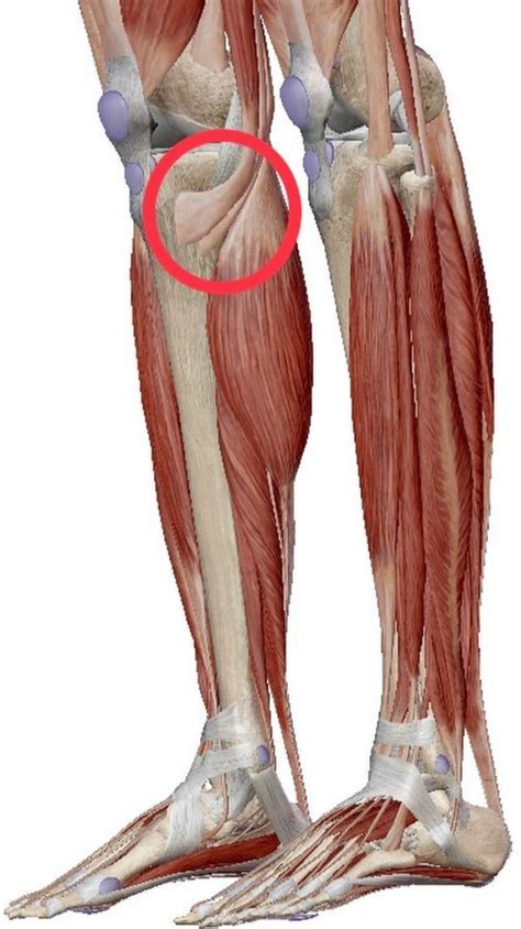 ¿tendinitis En La Pata De Ganso Biomecánica Martínez