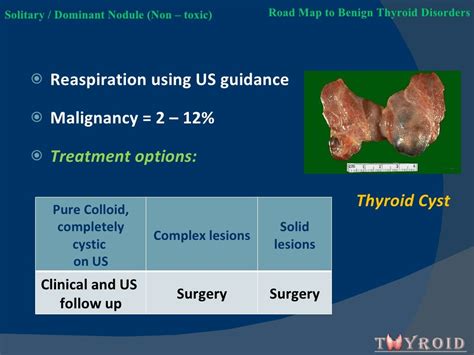 Solitary Thyroid Nodule Ppt By Dr Koorapati Ramesh