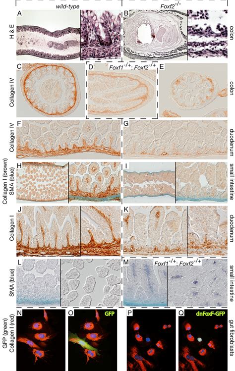 Tissue Disintegration Due To Ecm Deficiency In E Foxf Intestine