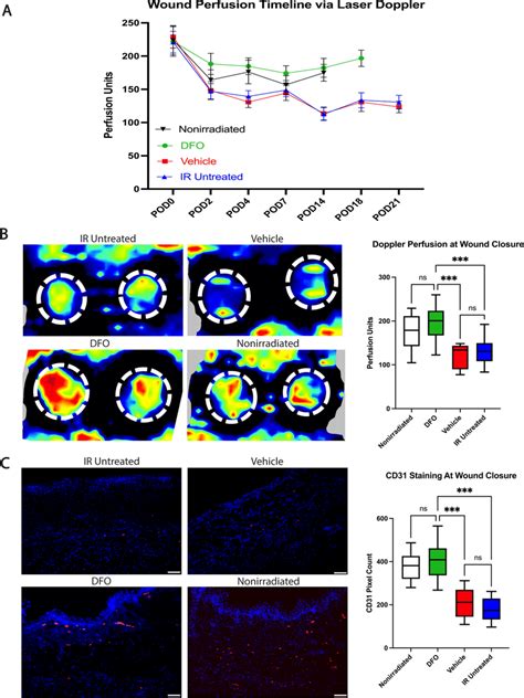 Vascular Changes In Healing Wounds A Perfusion As Measured By Laser