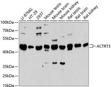 Anti Actrt3 抗体 Cab13198 Assay Genie