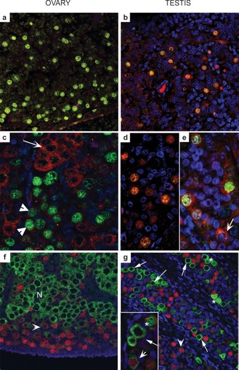 Distinct Subcellular Localization Of Oct 34 Dazl And Vasa In Human