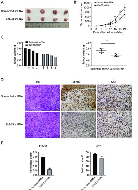 Knockdown Of Ephb Expression Inhibited Tumor Growth Of Escc In Vivo