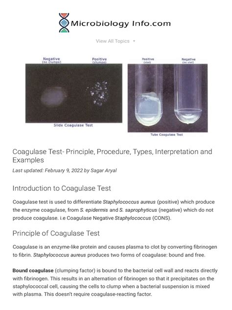 Coagulase Test - Principle, Procedure, Types, Interpretation and Examples | PDF | Laboratory ...