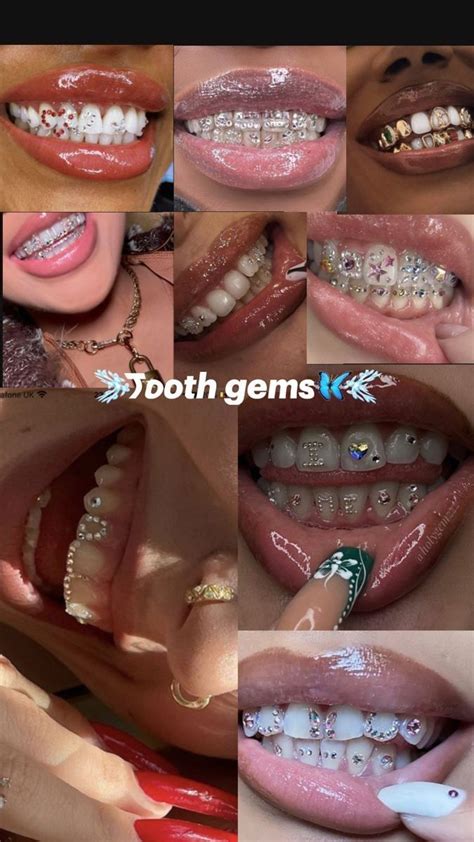 Tooth Gems Nel 2024 Cose Da Ragazze Piercing Denti