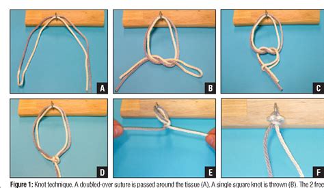 Figure 1 From The Doubled Suture Nice Knot Semantic Scholar