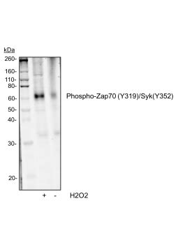 Phospho Zap Y Syk Y Recombinant Mab Abwiz Bio