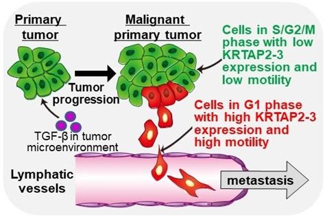 Stopping the spread: Targeting tumor metastasis