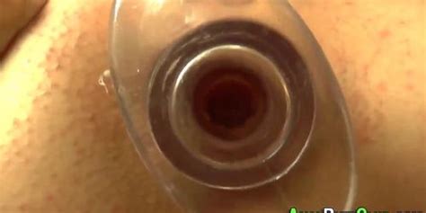 Anally Toyed Girl Gapes Cute Pussy Tnaflix