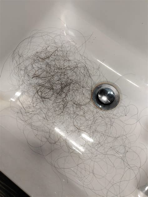 Can someone please tell me if this amount of hair fall is normal. I