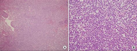 Conjunctival Lymphoid Tissue Hande Stained Sctions Showing Abnormal Download Scientific Diagram