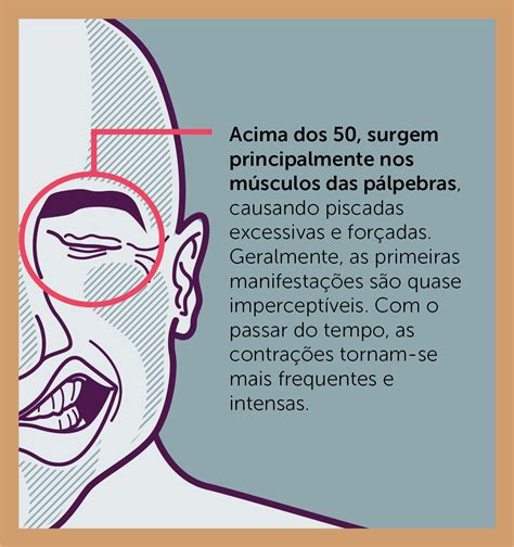 A Distonia é uma contração muscular involuntária Hcor