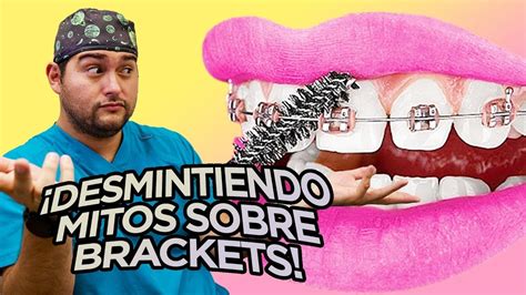 Hasta Que Edad Se Pueden Poner Brackets Mitos Desmentidos De La