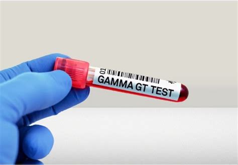 Gamma Gt Élevé Les Signaux Dalerte à Connaître Bien Etre Conseils Et Astuces Pour Mieux