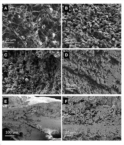 Cross Sectional View Of Clots Recorded With Scanning Electron Download Scientific Diagram