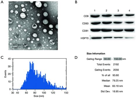 Characterization of exosomes isolated from serum. (A) The morphology of ... 