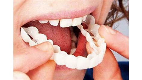 Накладные Зубы Snap On Smile Отзывы - YouTube