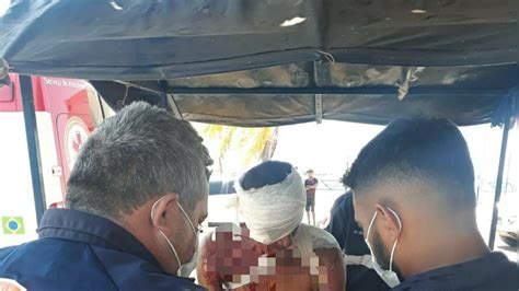 Morador Em Situa O De Rua Agredido Por Golpes De Gargalo De Garrafa