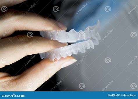 Fingers Woman Bitten By Invisible Orthodontics Stock Image Image Of