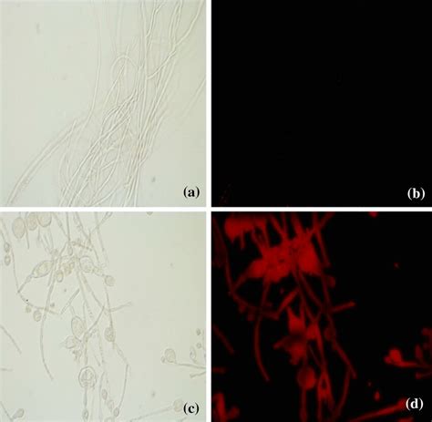 The morphology of Fusarium oxysporum f. sp. niveum under optical ...