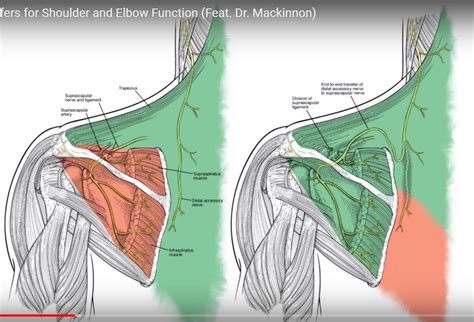 Ulnar Nerve Shoulder