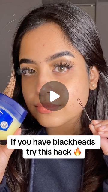 Doro Cubillo On Instagram If You Have Blackheads Try This Method To Remove Them 💦 With Clean