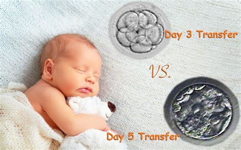 Should One Consider Request A Day Three Embryo Transfer Or Day Five Blastocyst Transfer Mcrm