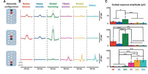 Figure 1 From Electrophysiological Guidance Of Epidural Electrode Array Implantation Over The